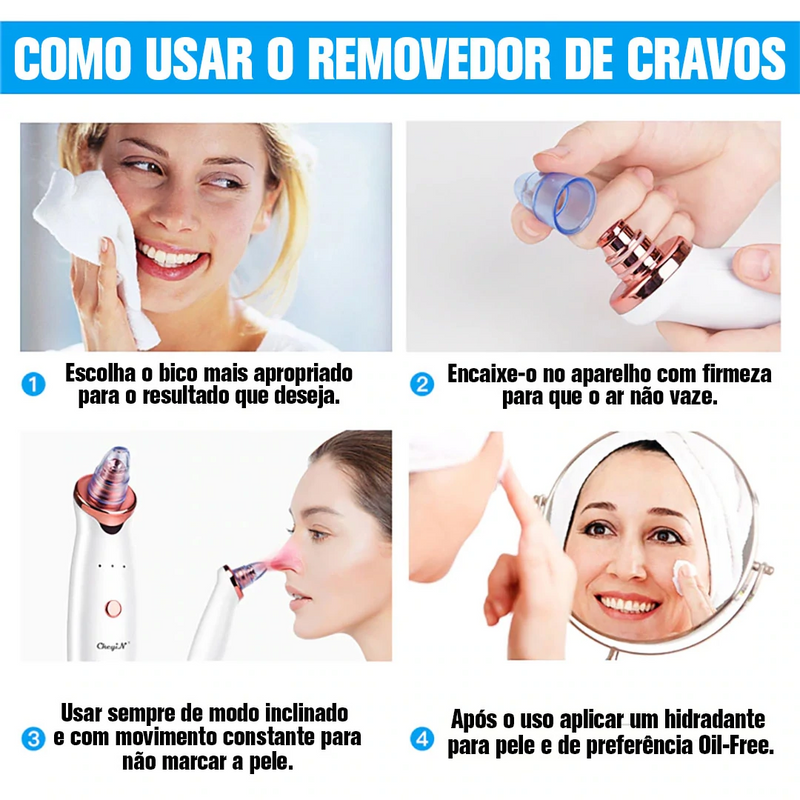 ™ Cleanser- Limpador De Cravos Por Sucção