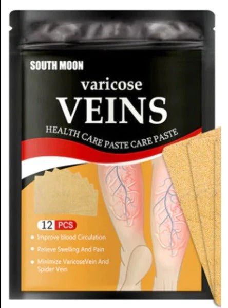 Varicose